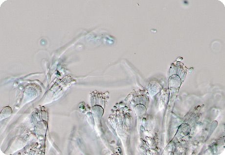 Üks Aspergillus perekonna seened 