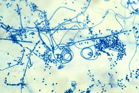 Jalade epidermofütoosi põhjustav toimeaine (Trichophyton interdigitale)