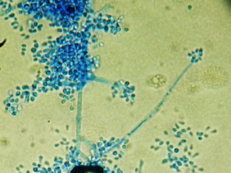 Faususe põhjustaja (Trichophyton schoenleinii)